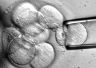 stem_cells