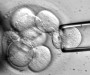 stem_cells